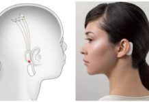 Elon Musk afirma que podremos transmitir música directa al cerebro neuralink musica