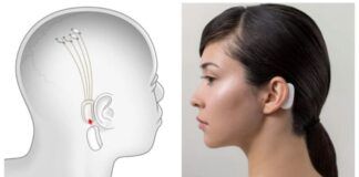 Elon Musk afirma que podremos transmitir música directa al cerebro neuralink musica